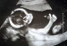 Rahīm: Refleksi Kasih Sayang, Kehidupan, Keberlanjutan dan Kebangkitan