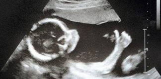 Rahīm: Refleksi Kasih Sayang, Kehidupan, Keberlanjutan dan Kebangkitan