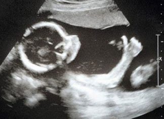 Rahīm: Refleksi Kasih Sayang, Kehidupan, Keberlanjutan dan Kebangkitan