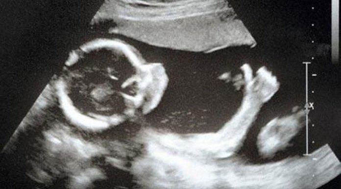 Rahīm: Refleksi Kasih Sayang, Kehidupan, Keberlanjutan dan Kebangkitan